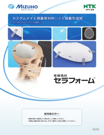 カスタムメイド頭蓋骨材料による頭蓋形成術 Manualzz