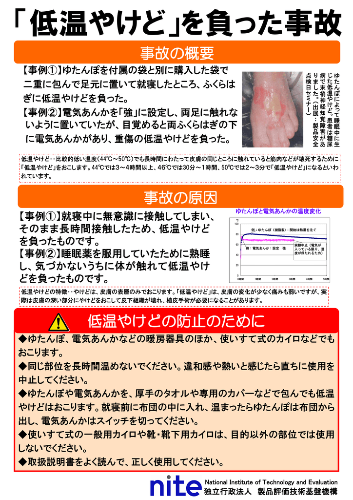 低温やけど を負った事故 Manualzz