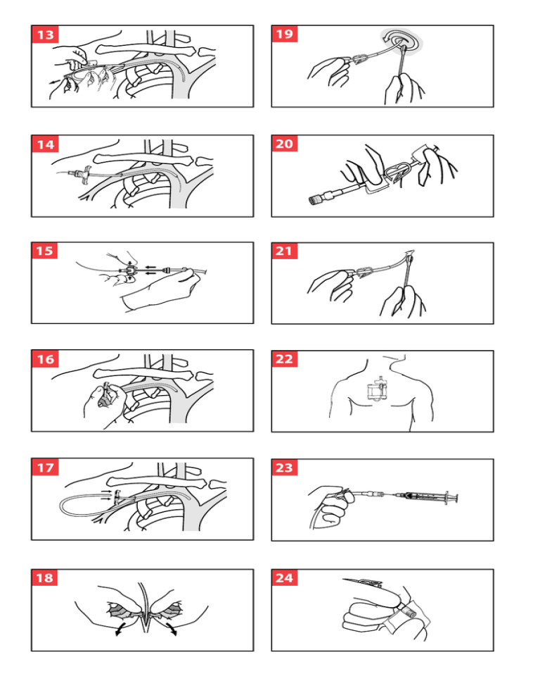 Clamp Here 1 2 3 4 5 Clamp Here Manualzz