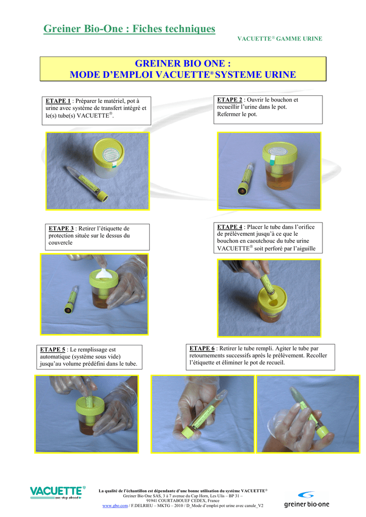 D_Mode d™emploi pot urine avec canule_V2 | manualzz.com