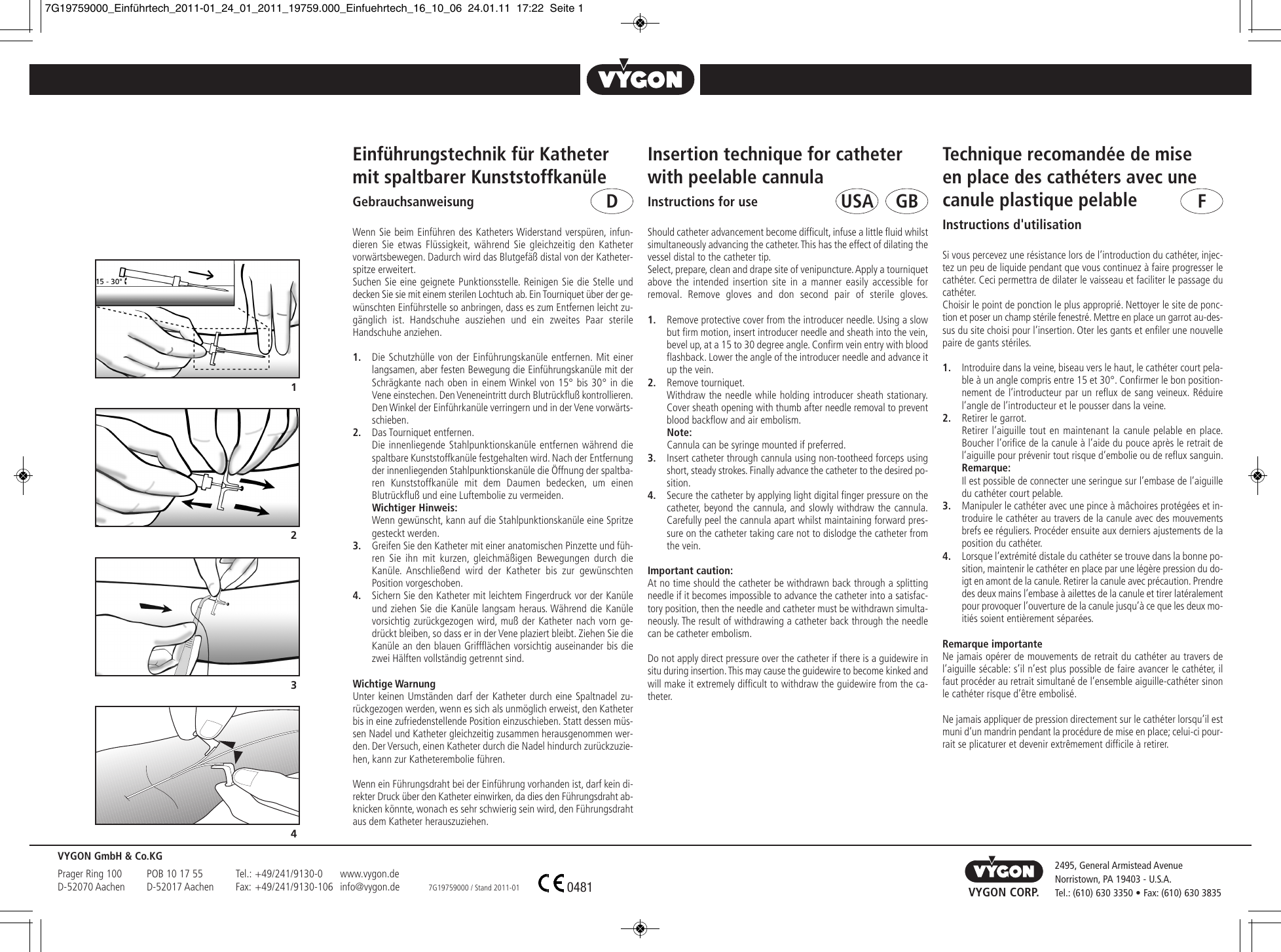 Einfuhrungstechnik Fur Katheter Mit Spaltbarer Manualzz