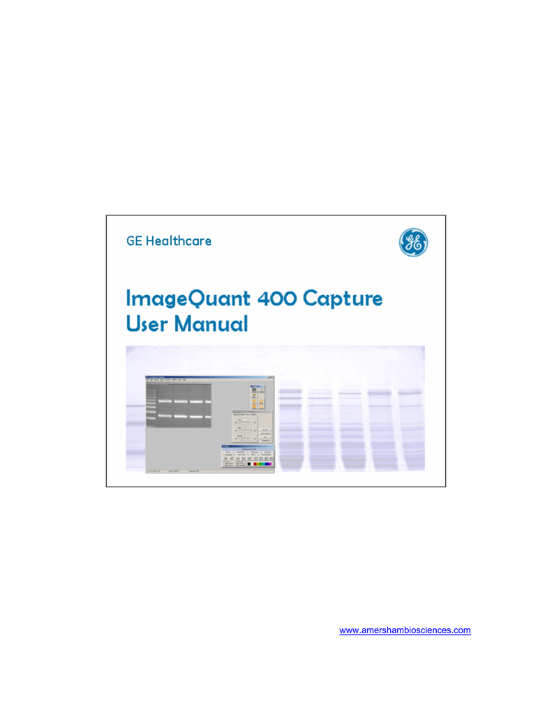 Imagequant tl iqtl software ge healthcare software