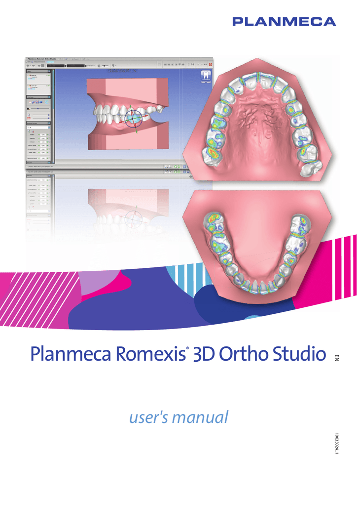 Planmeca romexis viewer недостаточно памяти для открытия 3d объема