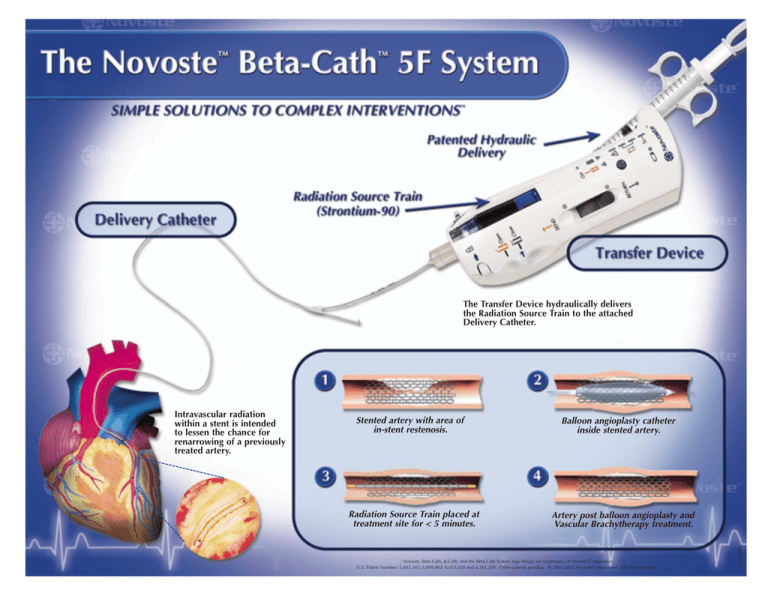 Beta-Cath™ 5F System Overview | Manualzz