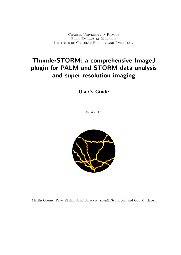 Thunderstorm A Comprehensive Imagej Plugin For Palm And